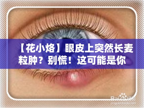 【花小烙】眼皮上突然长麦粒肿？别慌！这可能是你的眼睛在“摆烂”！